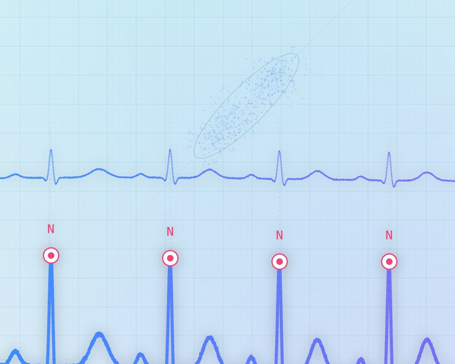 Rhythmusübersicht mit Poincaré-Plot